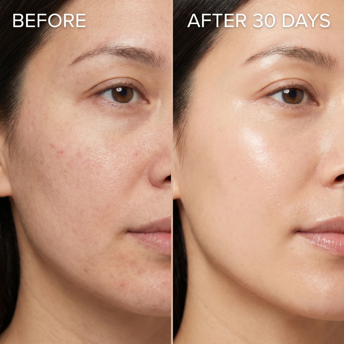 Before-After Beauty Comparison Ad